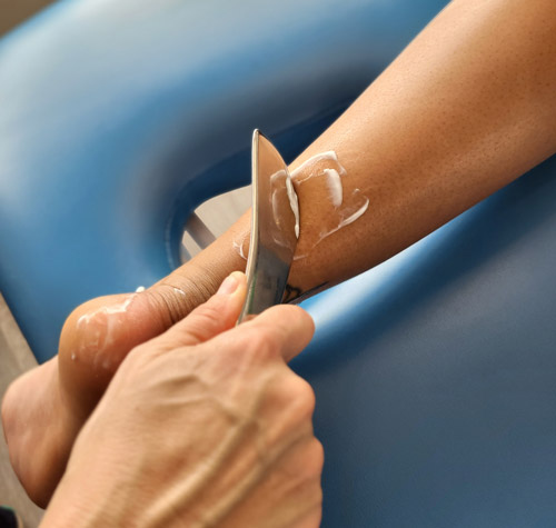 Soft tissue treatment for Achilles graston