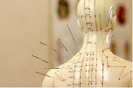 acupuncture for migraines