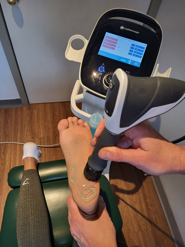 Shockwave therapy being used for foot pain