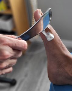 A scraper tool being used to release the soft tissue around the big toe