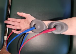 A person receiving treatment for Carpal Tunnel