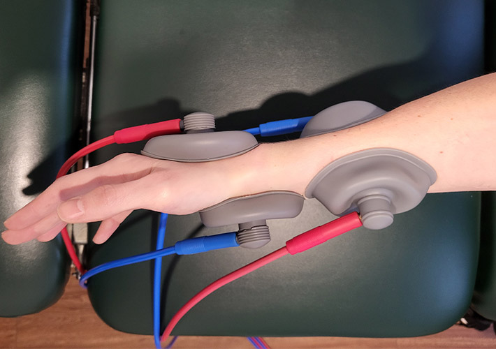 A person receiving treatment for Carpal Tunnel