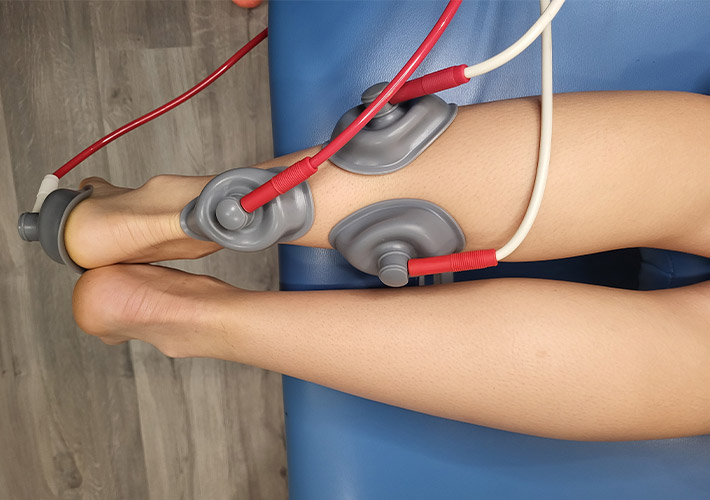 IFC treatment being performed for foot pain