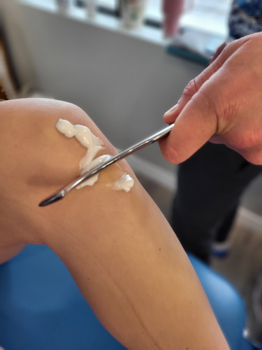 Doctor using graston therapy for knee pain