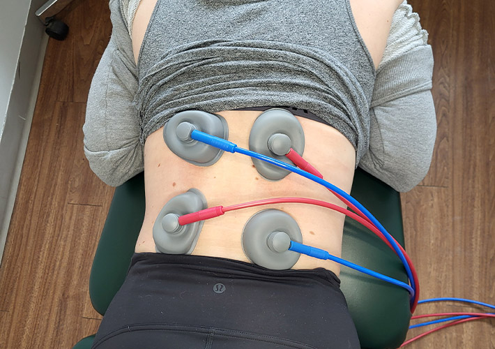 IFC treatment being used on patient for low back and sciatica pain