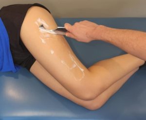 a scraping tool being used on the side of a female patients upper leg, patient is lying on her side on a physio table. The scraper tool looks like a dull knife.