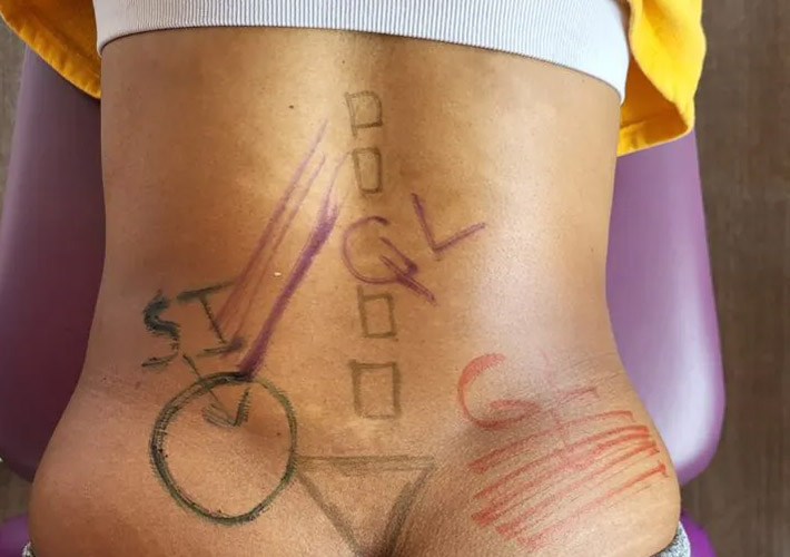 A picture showing pain points on lower back