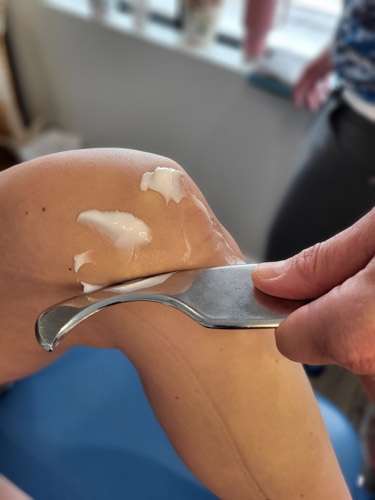 Active release therapy for medical knee pain