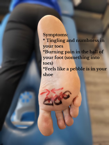 A graphic showing diagnose and treatment for Morton Neuroma