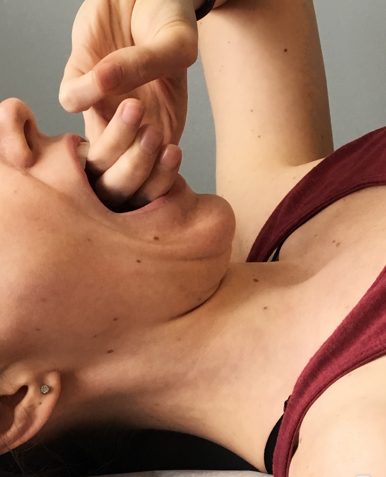 tmj test 3 fingers in mouth treatment oakville