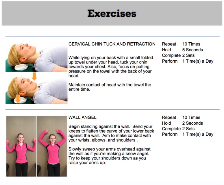 A graphic showing exercise for thoracic outlet syndrome