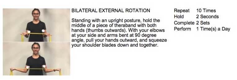 A graphic showing stretches for thoracic outlet syndrome