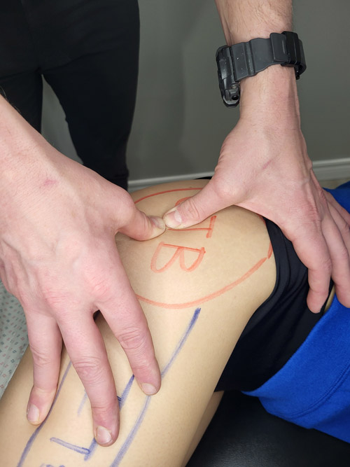 Physiotherapy treatment being performed on patient for Hip pain