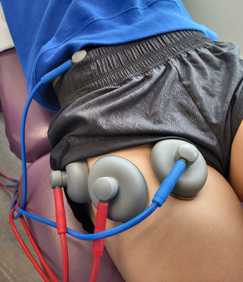 IFC treatment being used to treat patient's PSOAS pain