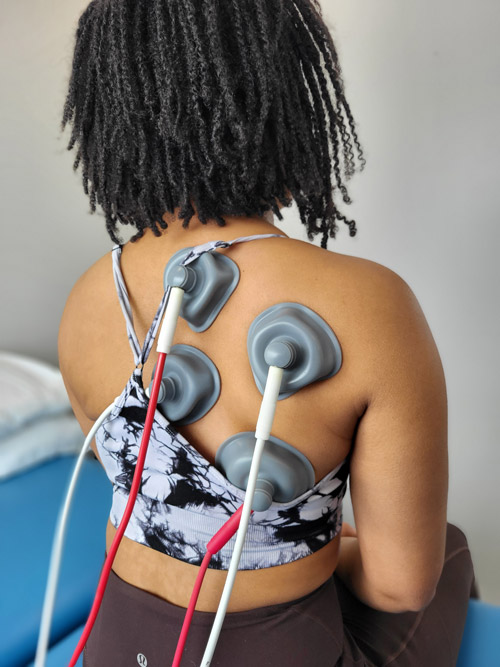 A female patient receiving IFC treatment for rib pain