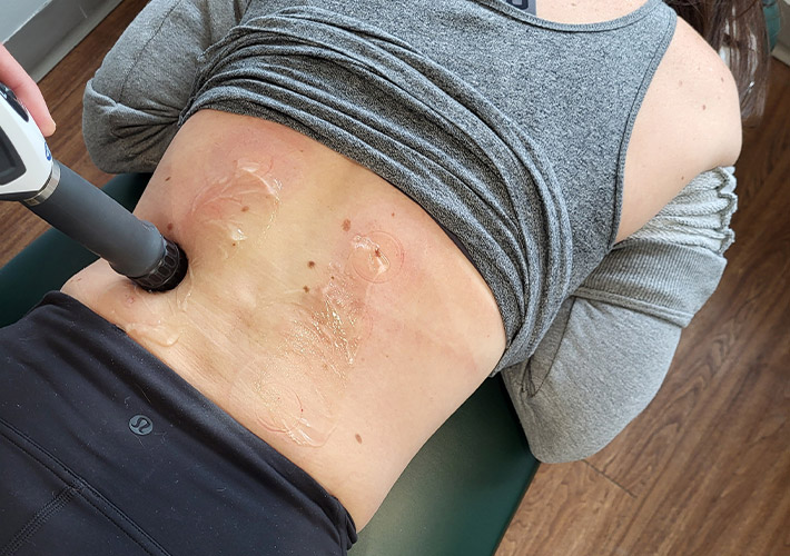 A patient receiving shockwave therapy for lower back and sciatica pain