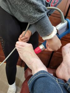 bunion treatment with a shockwave therapy unit