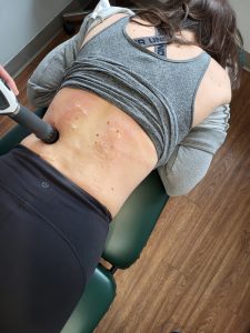 shockwave being applied to a patients low back