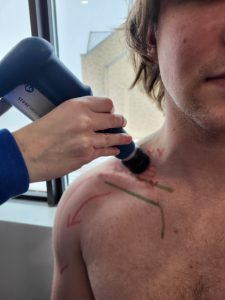 Shockwave Therapy on a patients thoracic outlet region, just above the collar bone!