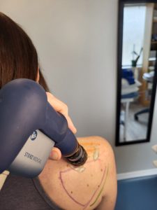 Patient getting shockwave treatment for shoulder pain