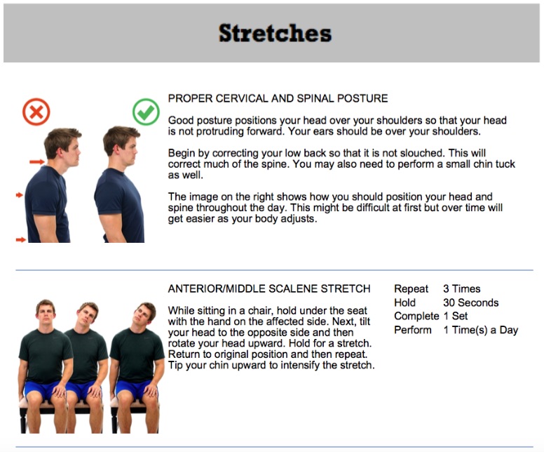 A graphic showing stretches for thoracic outlet syndrome