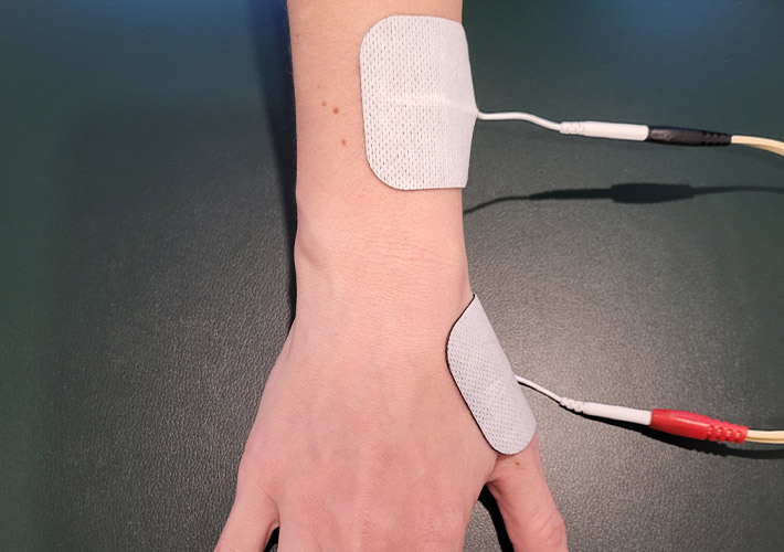 A patient receiving treatment for thumb pain