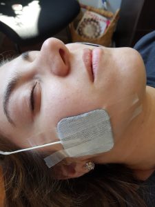 a female patient with ifc sticky pads taped to her face for jaw pain treatment