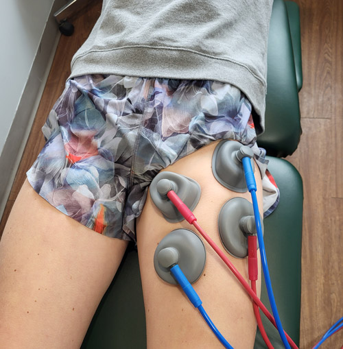 IFC treatment being used to treat patient's PSOAS pain