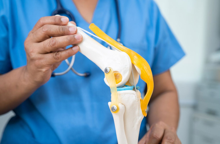 A graphic showing a doctor holding knee bone