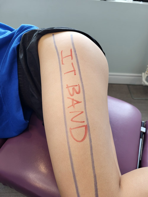 A person's leg with lines drawn in purple and red marker indicating the IT band area, with 'IT BAND' written in red along the side of the thigh.