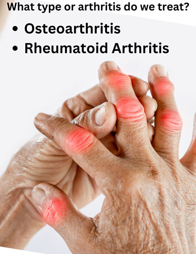 A graphic showing types of Arthritis get treated at Oakville clinic 