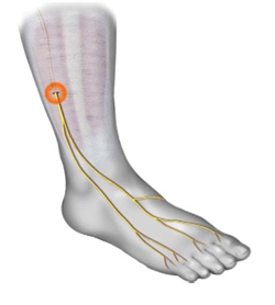 Compression socks. Compression stockings. pain relief.