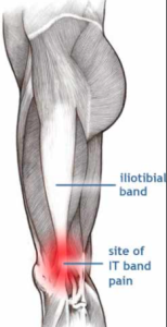 a side view of a leg showing where your IT band is located