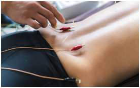 Acupuncture near me. Acupuncture pain treatment.